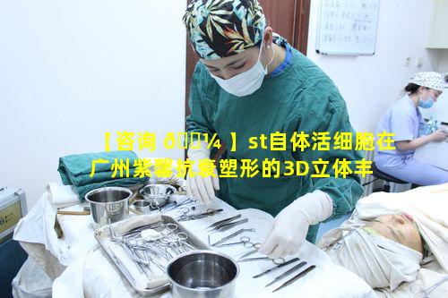 【咨询 🐼 】st自体活细胞在广州紫馨抗衰塑形的3D立体丰 🌼 盈效果如何
